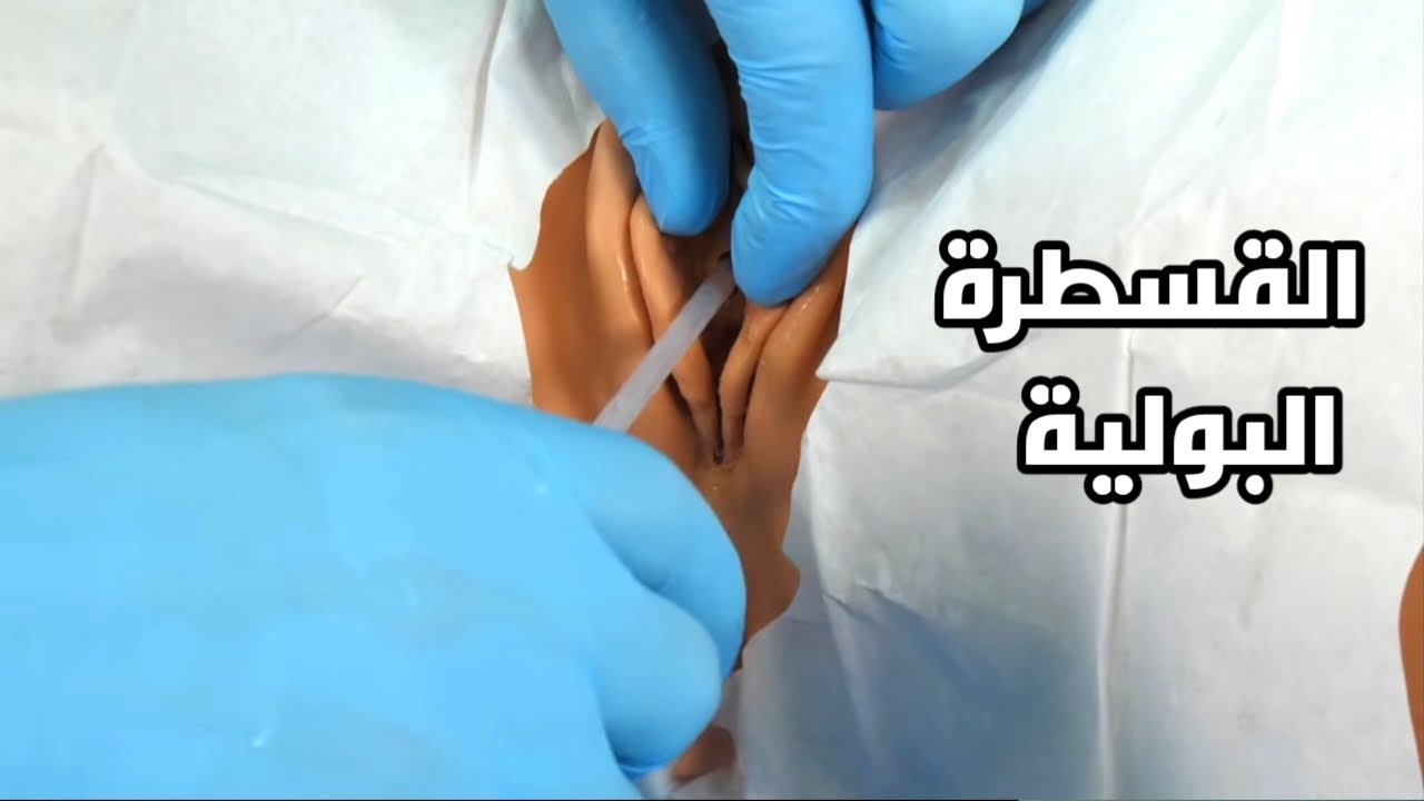 يد ممرضة بقفاز أزرق تركب قسطرة بولية بطريقة معقمة - تركيب القسطرة البولية في المنزل